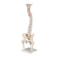 Erler Zimmer Standard Spine w. Prolapse and Pelvis, Diff....