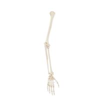 Erler Zimmer Arm Skeleton with Hand, Different Variants