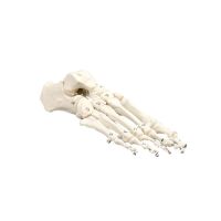 Erler Zimmer Foot Skeleton, Movable, Different Variants